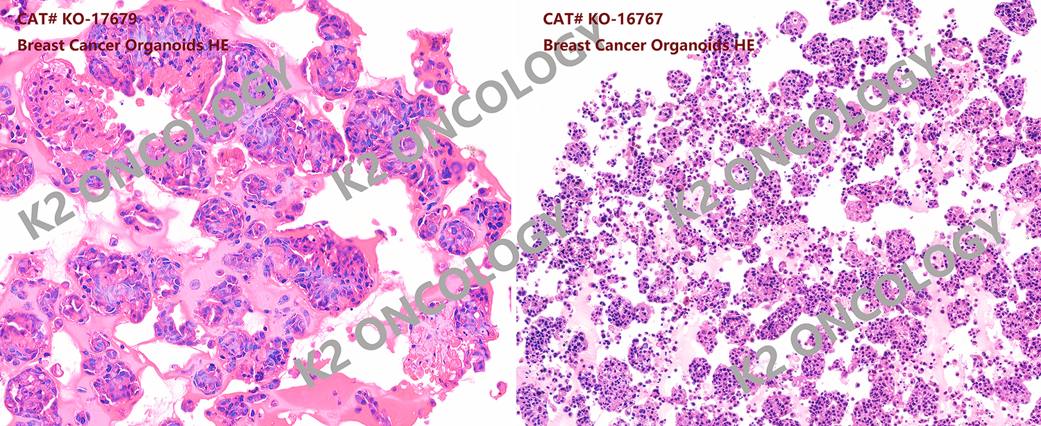 乳腺癌类器官模型HE染色照片.png