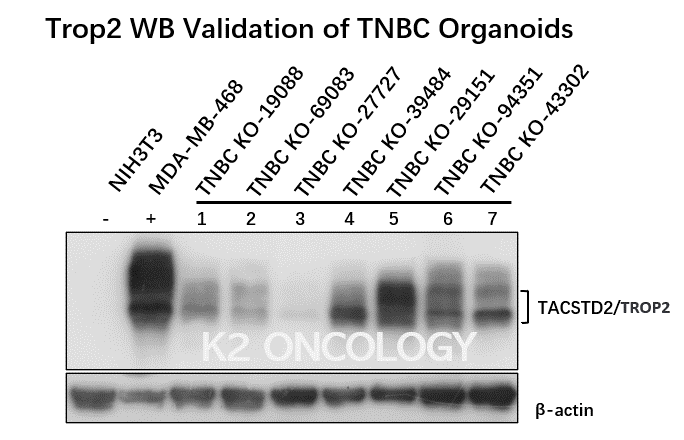 三阴性乳腺癌类器官模型（TNBC Organoids）WB验证Trop2 的表达.png