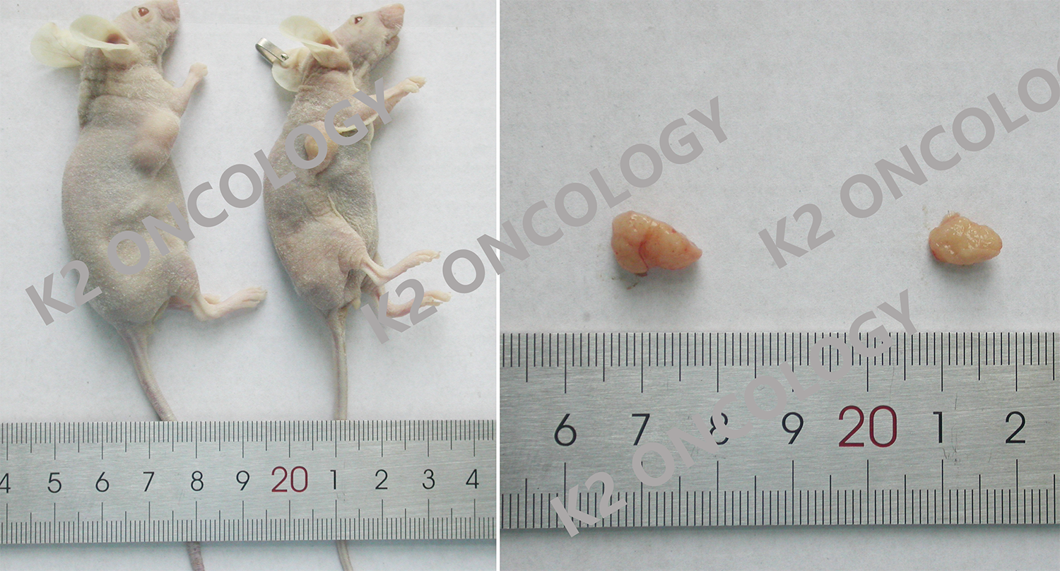 胃癌KO-99213类器官PDOX小鼠体内成瘤照片