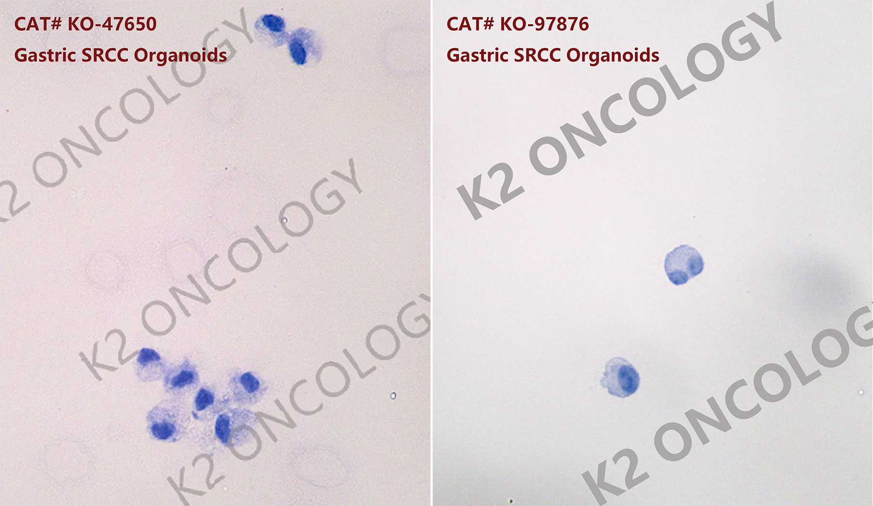 印戒细胞胃癌(SRCC)类器官模型的细胞染色照片.png
