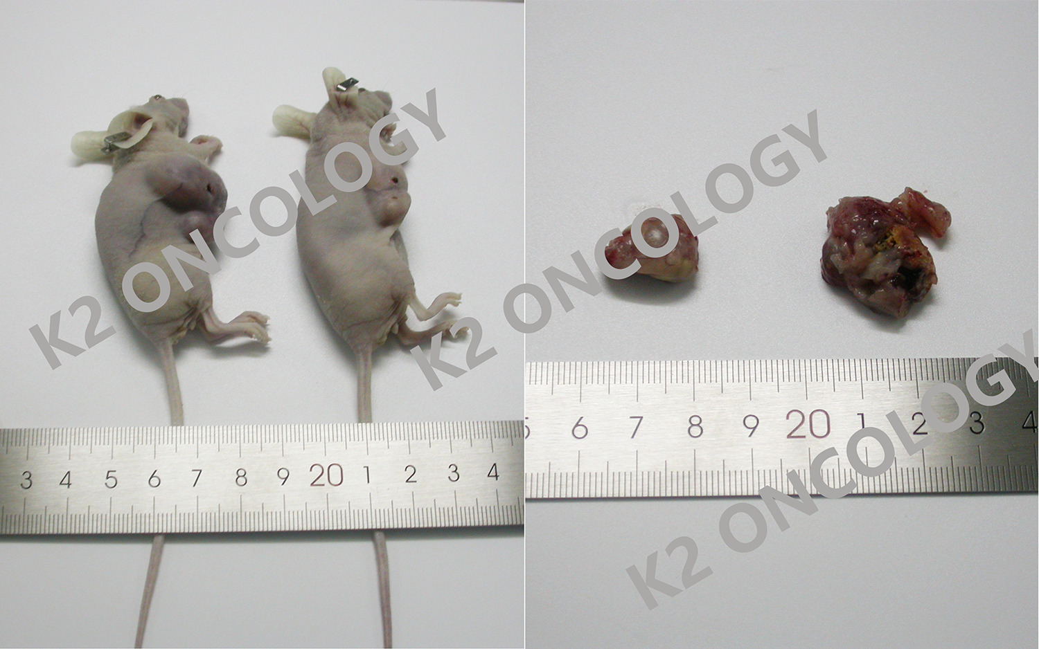 胃癌类器官KO-66744 PDOX小鼠体内成瘤照片.png
