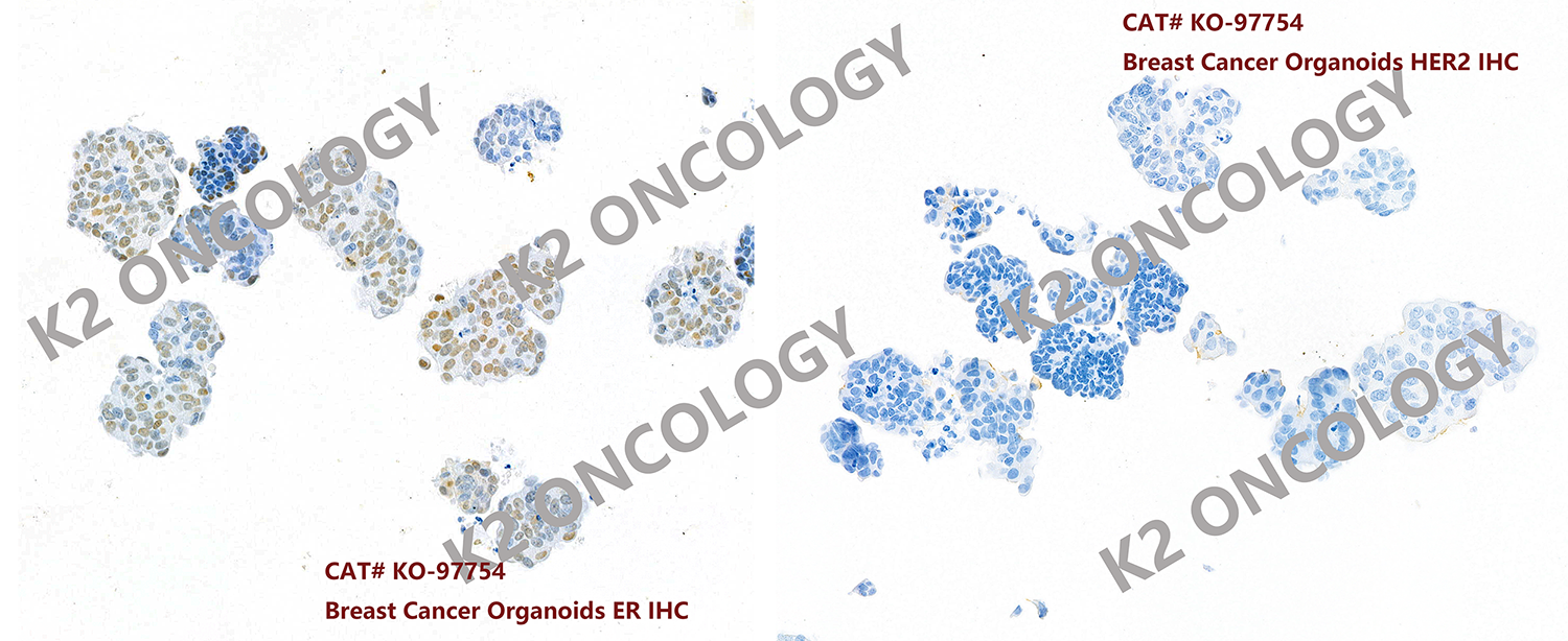 乳腺癌类器官模型KO-97754 ER(3+) 和HER2(-) IHC染色鉴定照片.png