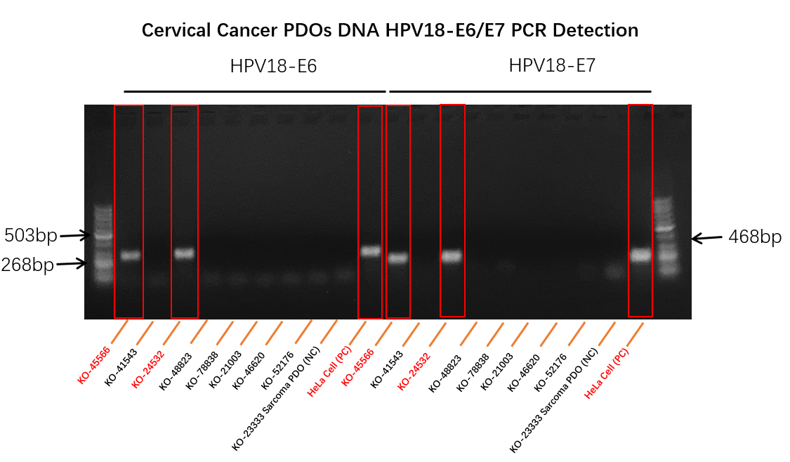 图4 宫颈癌KO-45566和KO-24532类器官模型DNA可检测到HPV-18 E6 E7 基因.png