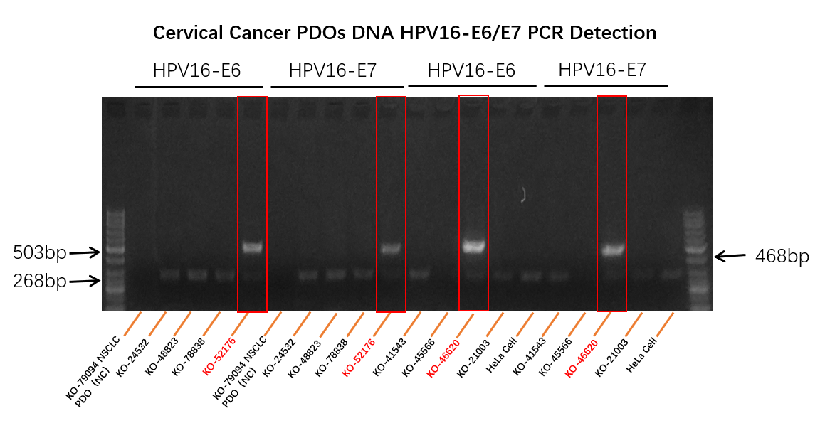 图2 宫颈癌KO-52176和KO-46620类器官模型DNA可检测到HPV-16 E6 E7 基因.png