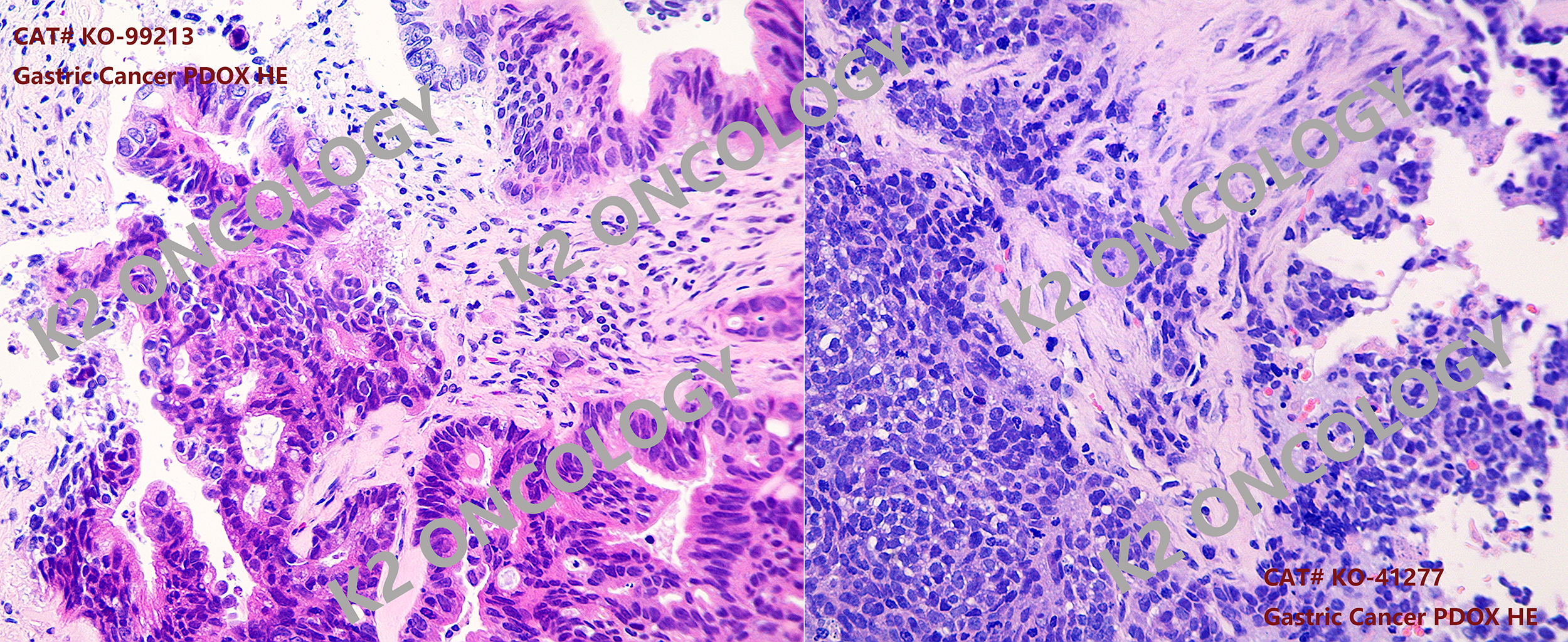 胃癌类器官PDOX小鼠模型（KO-99213和KO41277）的典型HE染色照片