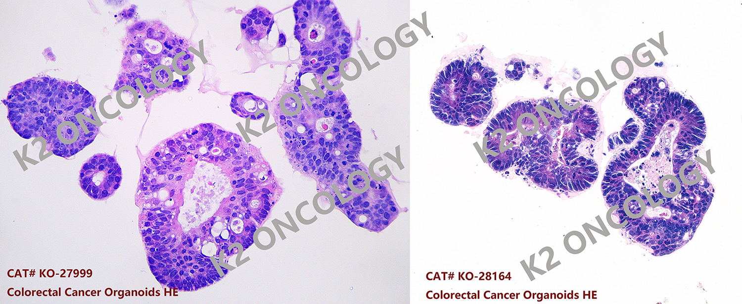 结直肠癌类器官模型的典型HE染色照片.png